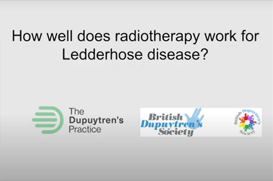 Exploring the effectiveness of radiotherapy in treating ledderhose disease, with information sources from the dupuytren's practice and british dupuytren's society.