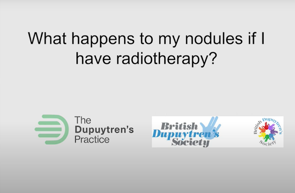 Educational slide questioning the effects of radiotherapy on nodules, with logos of the dupuytren's practice and british dupuytren's society.