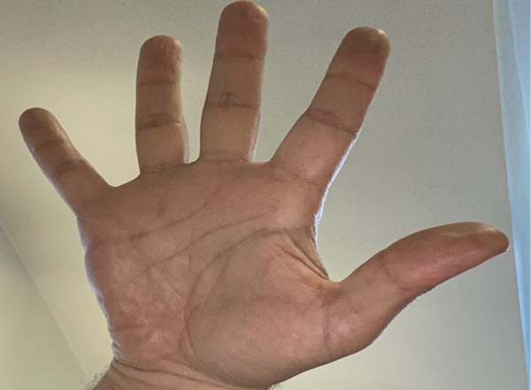 A human hand with fingers spread apart, palm facing the camera.