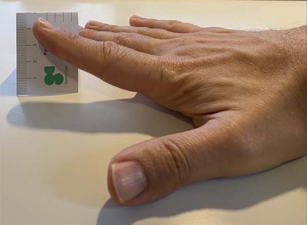 A human hand lying flat on a surface with a card showing a club symbol partially covered by the hand.